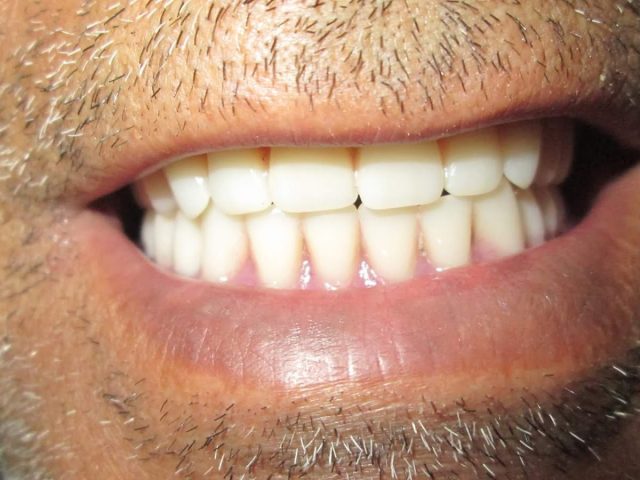 Labo Dentaire Allouch Mohamed - Segangan - +212 676-947364