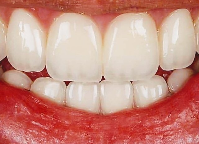 Docteur Sahir Tarik Dentiste - Béni Mellal - +212 5234-81760