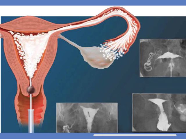 Radiologie DAKHLA - Khouribga - +212 80-8540173