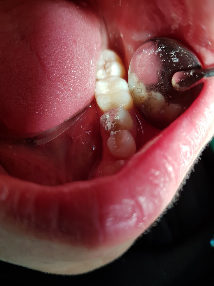 Docteur Chirurgien Dentiste ZINEBI Abdelali (Cabinet)