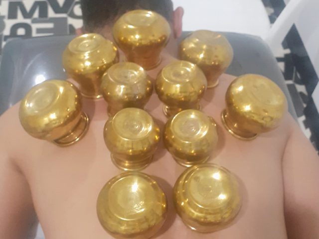 Markaz alhijam مركز الحجامة - Agadir - +212 667-907711