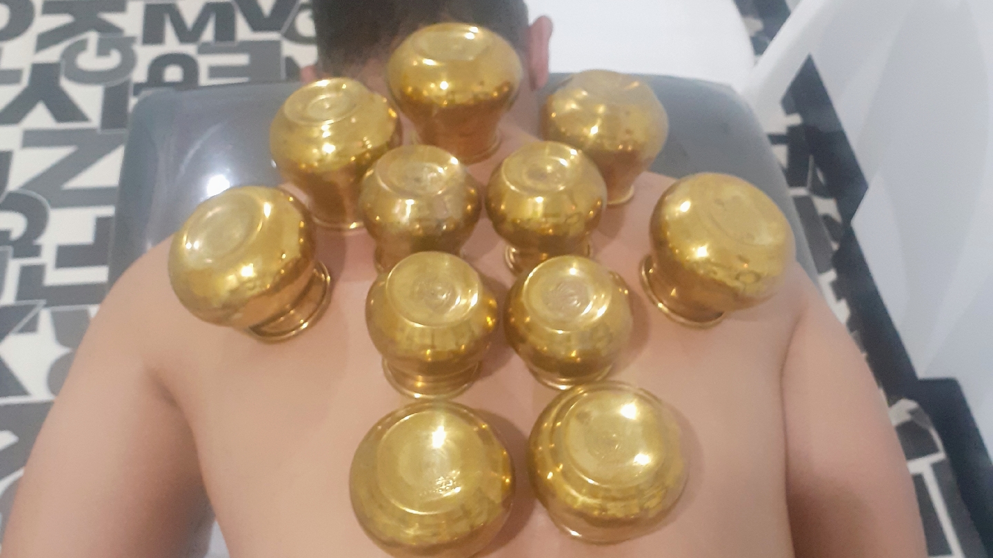Markaz alhijam مركز الحجامة