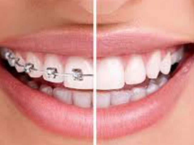 Dentiste - Cabinet Dentaire - Docteur BELLAOUD FATIMA ZAHRAE, طبيبة أسنان - Kénitra - +212 530-301692