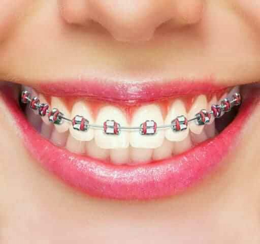 labo dentair - Midelt - +212 658-082400