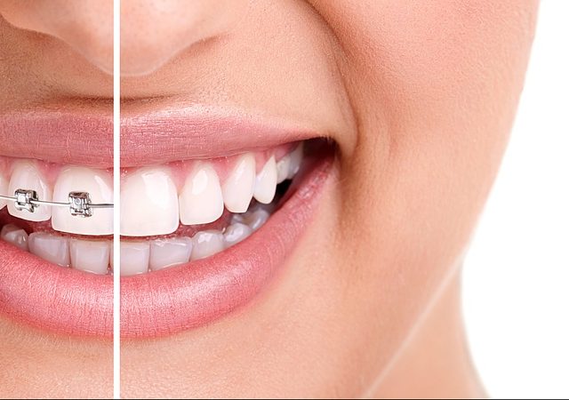 Docteur Chirurgien Dentiste El Hassouni Azeddine (Cabinet) - Mohammédia - +212 5233-22500