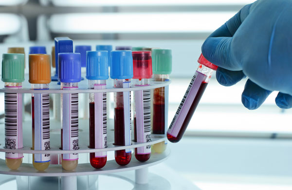 Laboratoire AL HAOUZ d'analyses médicales - Marrakech - +212 5242-08345