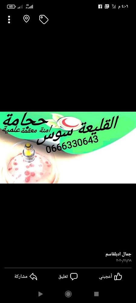 مركز العلاج بالحجامة جمال ادبلقاسم
