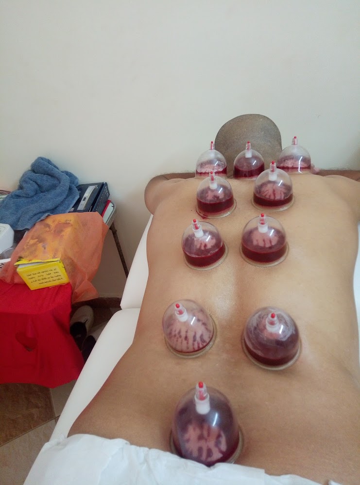 مركز الحجامة لحسن أقديم