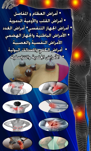 Cabinet arrahma hijama عيادة الرحمة للاستشفاء العلاج بالحجامة - Béni Mellal - +212 666-424833