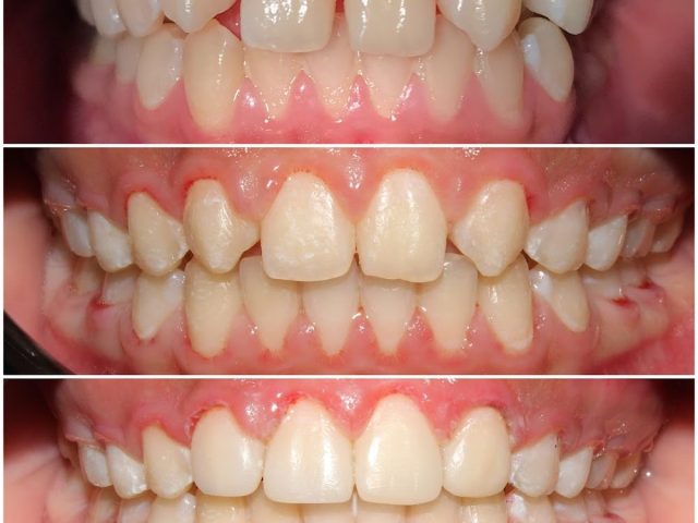 Dr Lahlali Nawal ( Chirurgien-dentiste,Orthodontiste) - Tanger - +212 5393-83460
