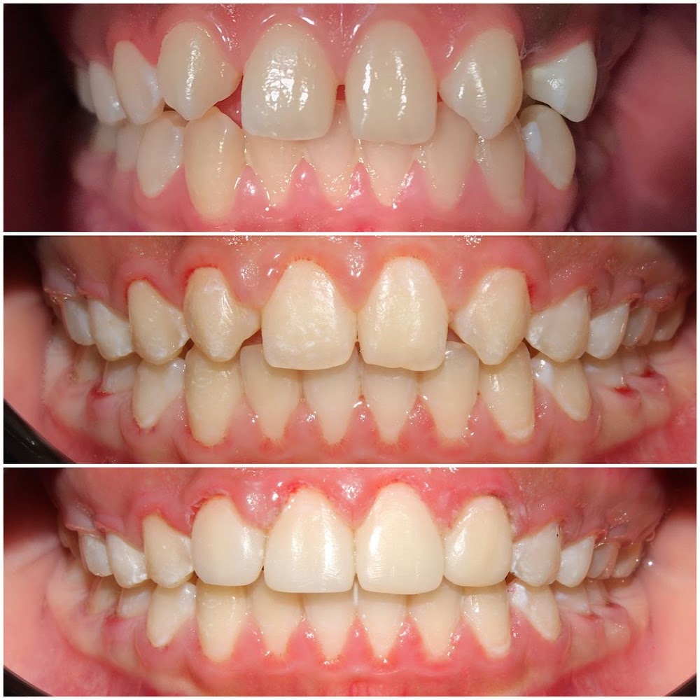 Dr Lahlali Nawal ( Chirurgien-dentiste