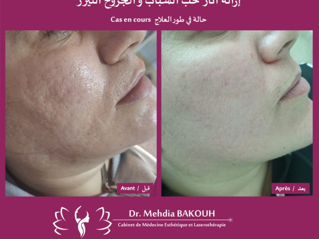 Dr Mehdia Bakouh - Médecine Esthétique et Laserothérapie - Tanger - +212 5399-30200