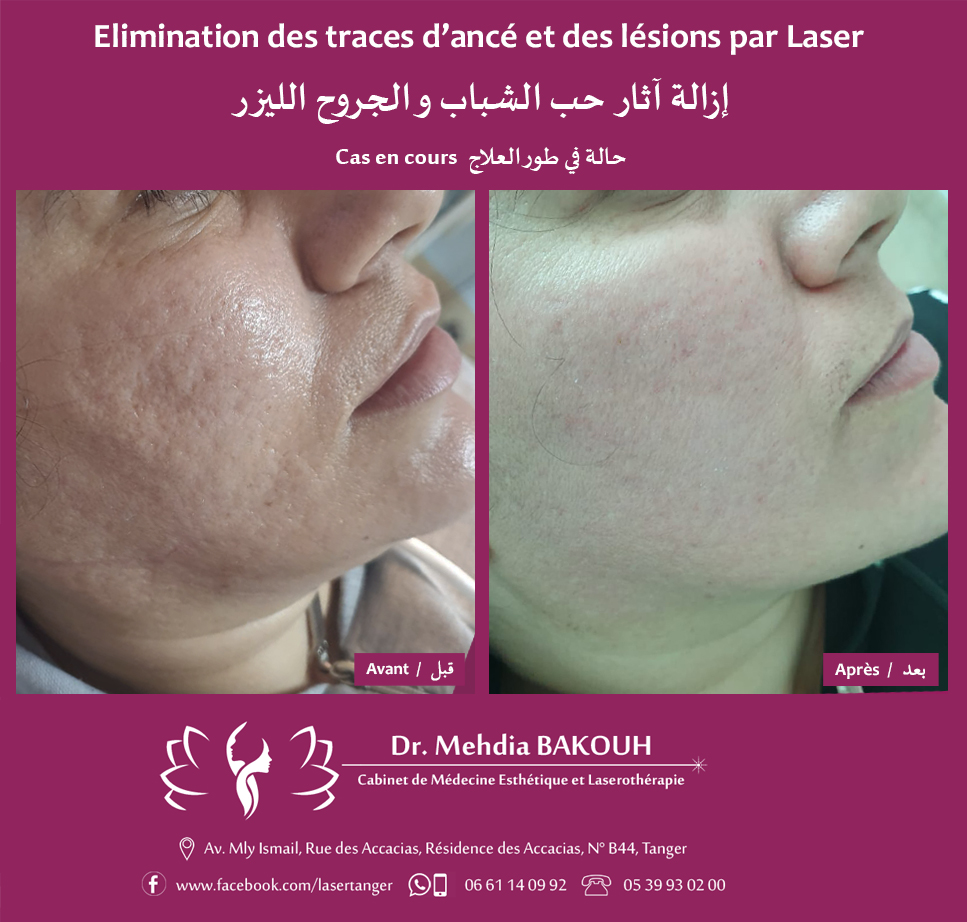 Dr Mehdia Bakouh - Médecine Esthétique et Laserothérapie