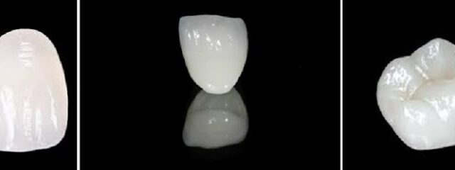 Al Wahda Dental Laboratory - Abu Dhabi - +971 6 554 1538