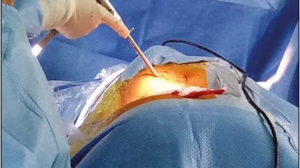 Mohammed Almahmood , Consultant Orthopaedic Surgeon - Abu Dhabi - +971 3 764 0361