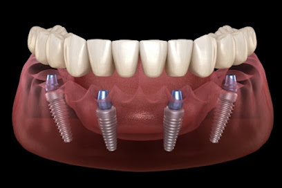 Dental Implantologist UAE - Fujairah - +971 58 521 7979